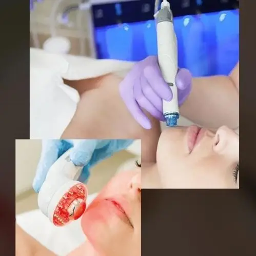 AquaFacial Behandlung mit LightTherapie bei Aura Ästhetik